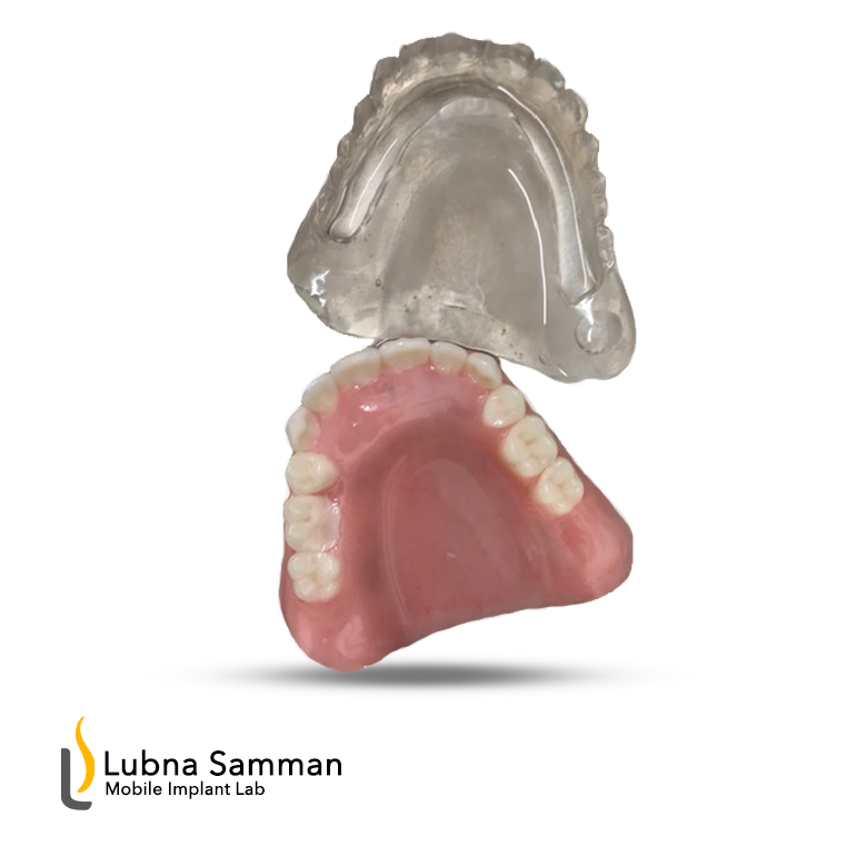 All on X Conversion Package