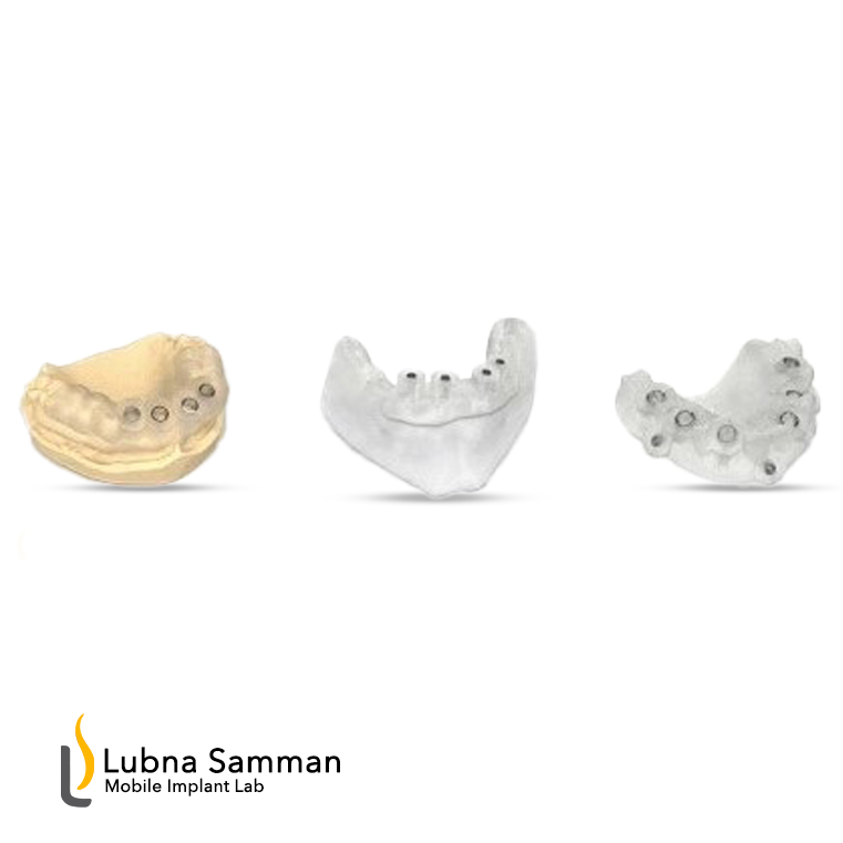 Radiographicstent and Surgical guide